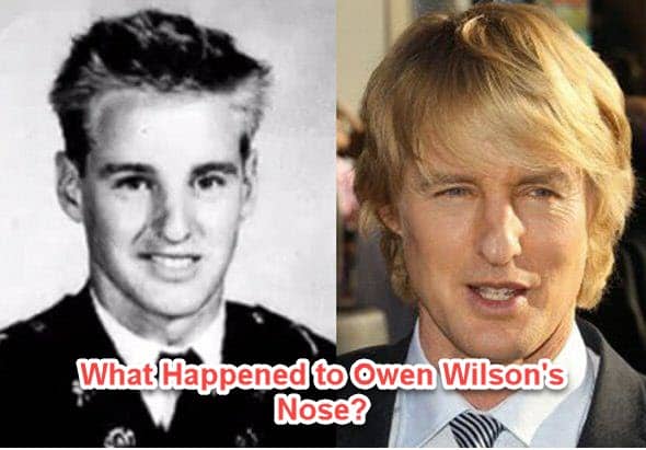 The Motorcycle Accident That Shaped Owen Wilson’s Nose